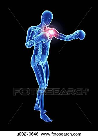 Stock Photograph - 3d rendered illustration of an athlete's painful shoulder.. Fotosearch