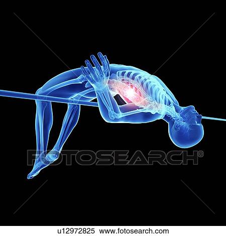 Stock Photography - 3d rendered illustration of an athlete's painful spine.. Fotosearch