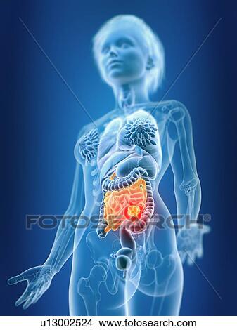 Picture - 3d rendered illustration of female small intestine.. Fotosearch