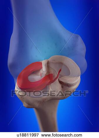 3d rendered illustration of the lateral meniscus. View Large Photo Image Stock Photo - 3d rendered illustration of the lateral meniscus.. Fotosearch
