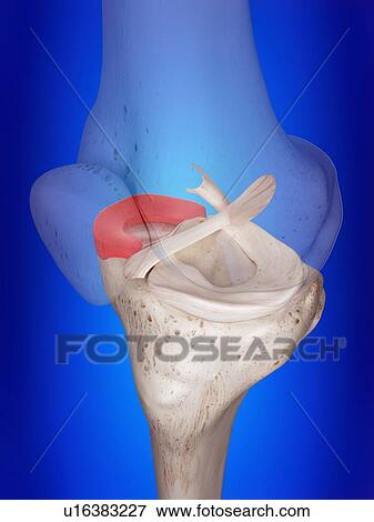 Stock Photo - 3d rendered illustration of the medial meniscus.. Fotosearch