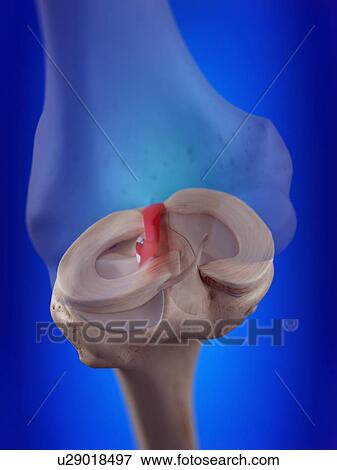 Stock Photo - 3d rendered illustration of the anterior cruciate ligament.. Fotosearch