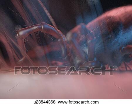 Stock Photo - 3d rendered illustration of tick in human skin.. Fotosearch