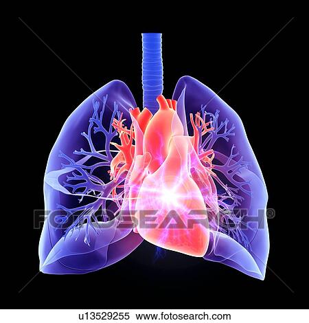 Stock Photography - Heart attack, conceptual illustration.. Fotosearch