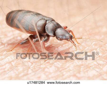Picture - Illustration of a bedbug on human skin.. Fotosearch