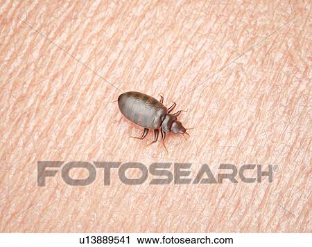 Stock Image - Illustration of a bedbug on human skin.. Fotosearch