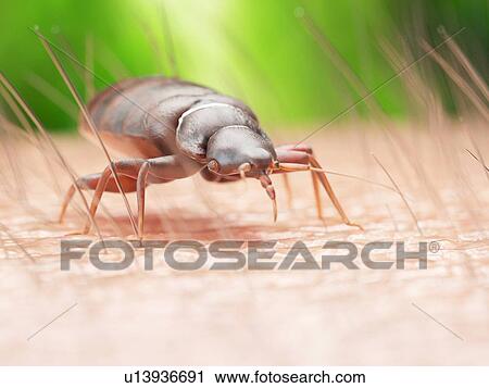 Stock Image - Illustration of a bedbug on human skin.. Fotosearch