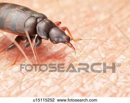 Stock Image - Illustration of a bedbug on human skin.. Fotosearch
