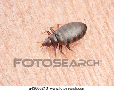 Illustration of a bedbug on human skin. View Large Photo Image Stock Image - Illustration of a bedbug on human skin.. Fotosearch