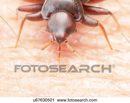 Stock Image - Illustration of a bedbug on human skin.. Fotosearch