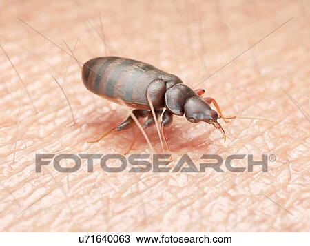 Stock Image - Illustration of a bedbug on human skin.. Fotosearch