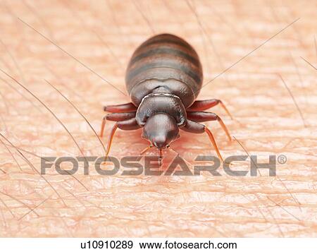 Illustration of a bedbug on human skin. View Large Photo Image Stock Photo - Illustration of a bedbug on human skin.. Fotosearch