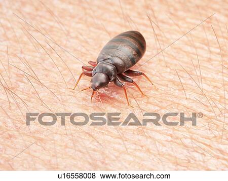 Stock Photo - Illustration of a bedbug on human skin.. Fotosearch