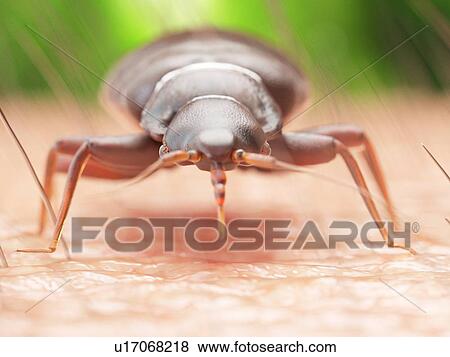 Stock Photo - Illustration of a bedbug on human skin.. Fotosearch