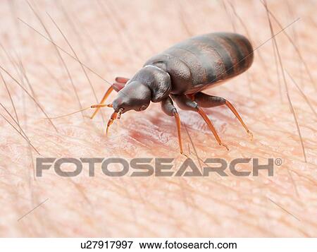 Stock Photo - Illustration of a bedbug on human skin.. Fotosearch