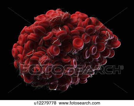 Stock Photo - Illustration of a blood clot.. Fotosearch