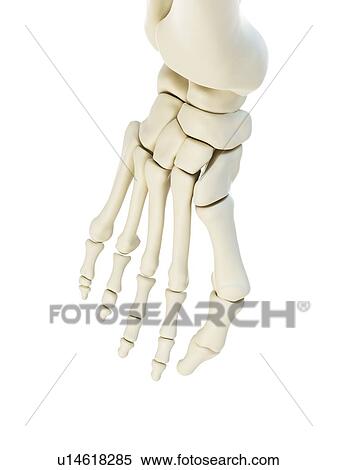 Illustration of a bunion. View Large Photo Image Stock Photography - Illustration of a bunion.. Fotosearch