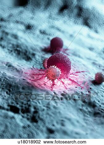 Stock Image - Illustration of a cancer cell being attacked by white blood cells.. Fotosearch