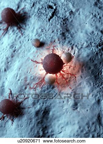Stock Image - Illustration of a cancer cell being attacked by white blood cells.. Fotosearch