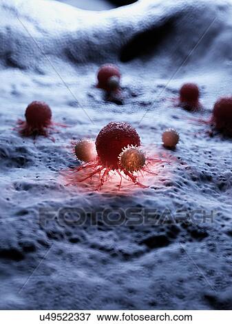 Illustration of a cancer cell being attacked by white blood cells. View Large Photo Image Stock Photo - Illustration of a cancer cell being attacked by white blood cells.. Fotosearch