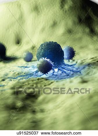 Stock Photo - Illustration of a cancer cell being attacked by white blood cells.. Fotosearch
