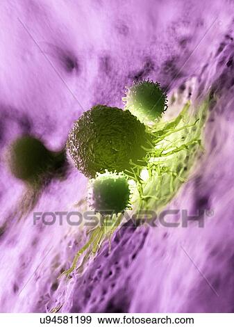 Illustration of a cancer cell being attacked by white blood cells. View Large Photo Image Stock Photo - Illustration of a cancer cell being attacked by white blood cells.. Fotosearch