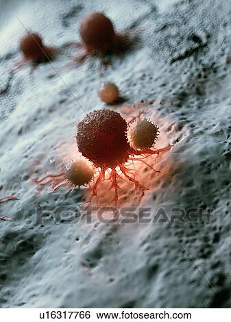 Illustration of a cancer cell being attacked by white blood cells. View Large Photo Image Stock Photograph - Illustration of a cancer cell being attacked by white blood cells.. Fotosearch