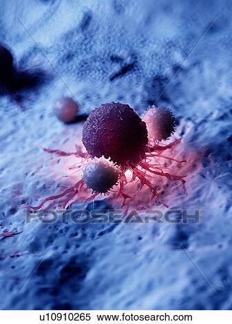 Illustration of a cancer cell being attacked by white blood cells. View Large Photo Image Stock Photography - Illustration of a cancer cell being attacked by white blood cells.. Fotosearch