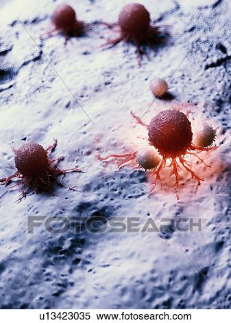 Illustration of a cancer cell being attacked by white blood cells. View Large Photo Image Stock Photography - Illustration of a cancer cell being attacked by white blood cells.. Fotosearch
