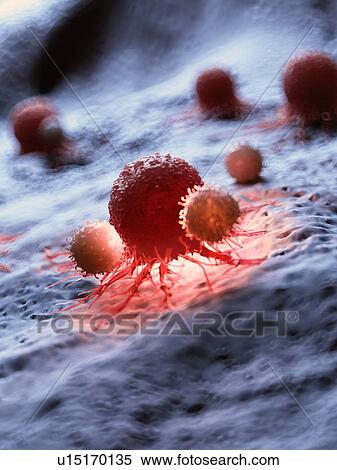 Stock Photography - Illustration of a cancer cell being attacked by white blood cells.. Fotosearch