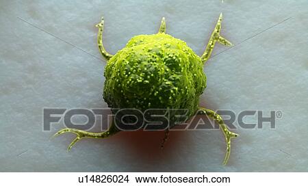 Picture - Illustration of a cancer cell.. Fotosearch