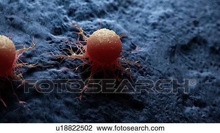 Stock Image - Illustration of a cancer cell.. Fotosearch