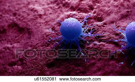 Stock Image - Illustration of a cancer cell.. Fotosearch