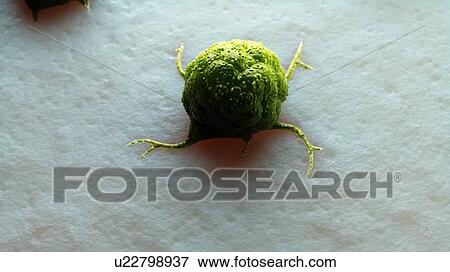 Stock Photo - Illustration of a cancer cell.. Fotosearch