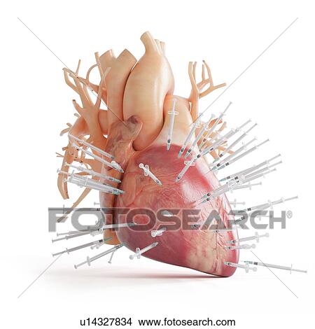 Picture - Illustration of a heart spiked with syringes.. Fotosearch