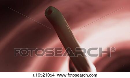 Picture - Illustration of a hookworm.. Fotosearch