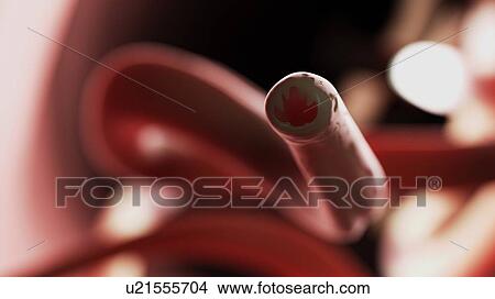 Illustration of a hookworm. View Large Photo Image Picture - Illustration of a hookworm.. Fotosearch