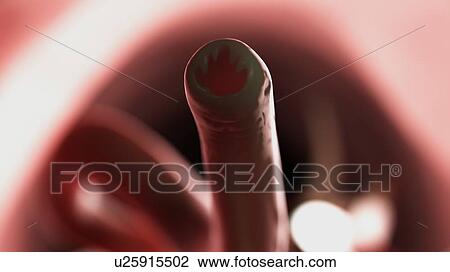 Stock Image - Illustration of a hookworm.. Fotosearch