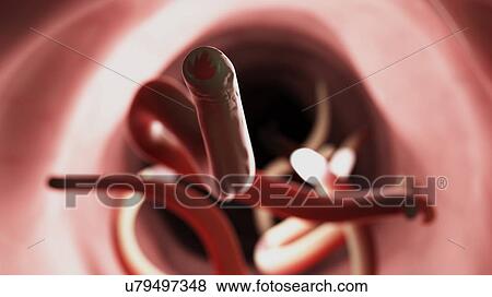 Stock Photo - Illustration of a hookworm.. Fotosearch
