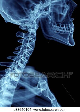 Picture - Illustration of a man's cervical spine.. Fotosearch