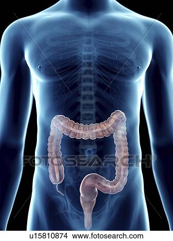 Picture - Illustration of a man's colon.. Fotosearch