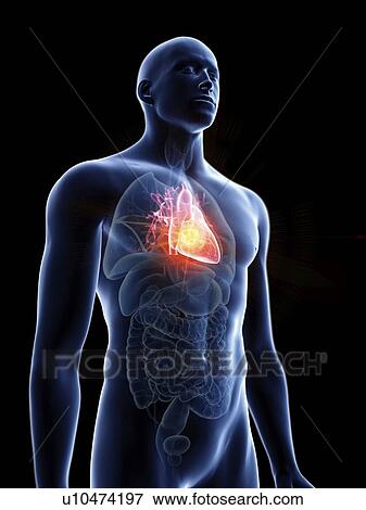 Illustration of a man's heart tumour. View Large Photo Image Stock Photo - Illustration of a man's heart tumour.. Fotosearch