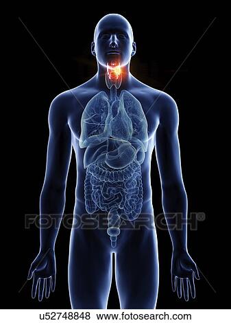Stock Photo - Illustration of a man's larynx cancer.. Fotosearch