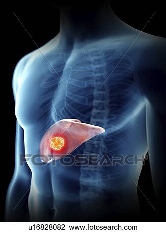 Illustration of a man's liver. View Large Photo Image Stock Image - Illustration of a man's liver.. Fotosearch