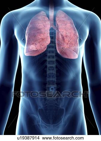 Picture - Illustration of a man's lung.. Fotosearch