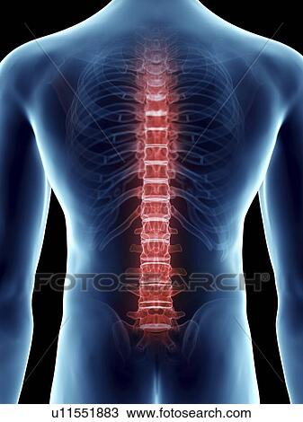 Stock Image - Illustration of a man's painful back.. Fotosearch