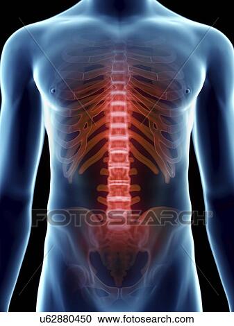 Illustration of a man's painful spine. View Large Photo Image Stock Image - Illustration of a man's painful spine.. Fotosearch