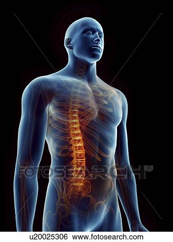 Stock Photograph - Illustration of a man's painful spine.. Fotosearch