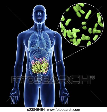 Illustration of a man's small intestine infection. View Large Photo Image Picture - Illustration of a man's small intestine infection.. Fotosearch
