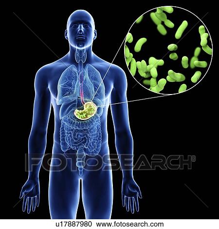 Stock Image - Illustration of a man's stomach infection.. Fotosearch